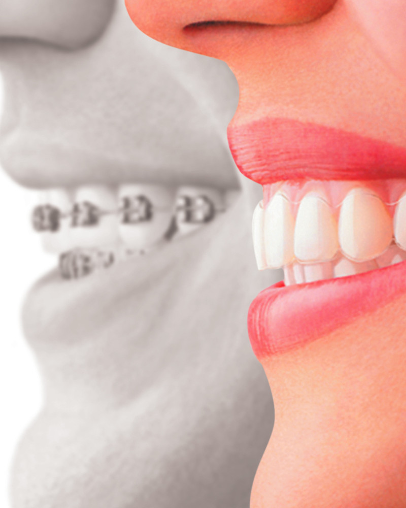 orthodontie